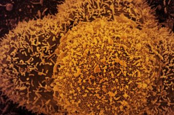 Nesta  TERÇA FEIRA, dia 04 de Janeiro, a UBS Farmacêutico Raul da Costa Câmara estará aberta para vacinação contra COVID. Entrega de senhas a partir das 07 horas. Será distribuída 01 senha por pessoa.   