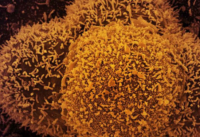 Nesta  TERÇA FEIRA, dia 04 de Janeiro, a UBS Farmacêutico Raul da Costa Câmara estará aberta para vacinação contra COVID. Entrega de senhas a partir das 07 horas. Será distribuída 01 senha por pessoa.   